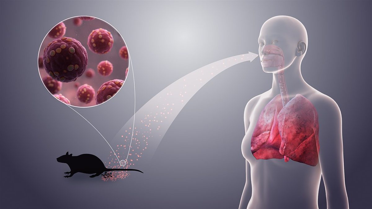 3D medical animation still showing Hantavirus. Source: https://www.scientificanimations.com (CC licensed )